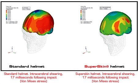 激光头盔SuperSkin -脑内剪切图